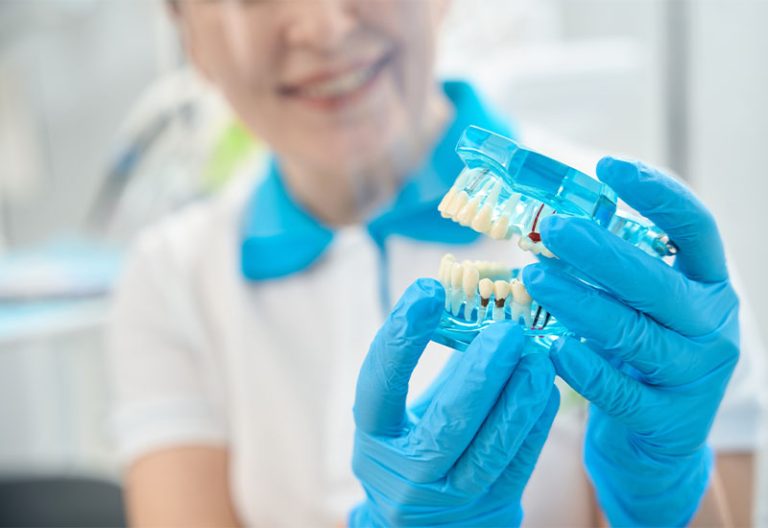 Central Dental Family - Dentist showing their patient an example of dental implants