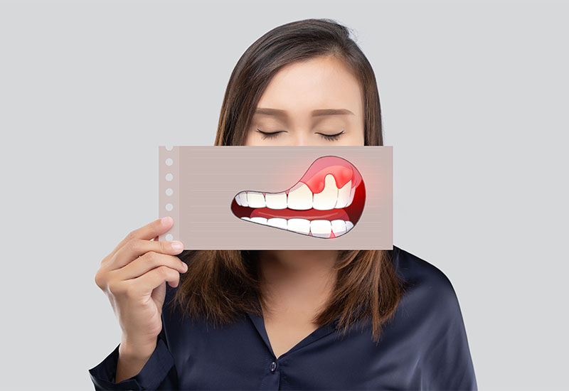 Central Dental Family - Patient showing their abscessed tooth